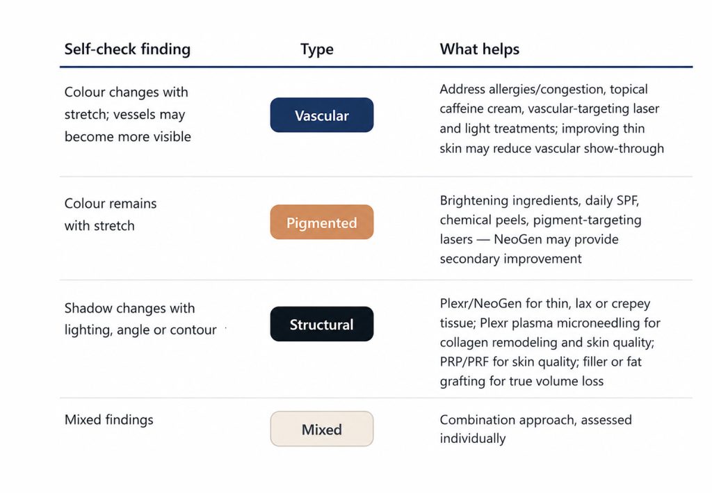 Quick reference table showing dark circle self-check findings, type, and recommended treatments