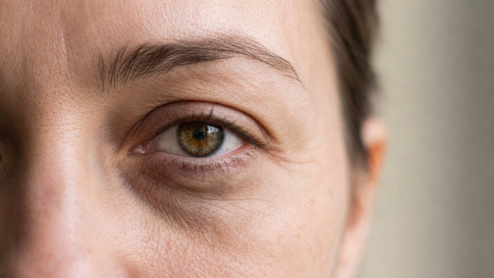 Close-up of an eye showing under-eye dark circles and fine lines