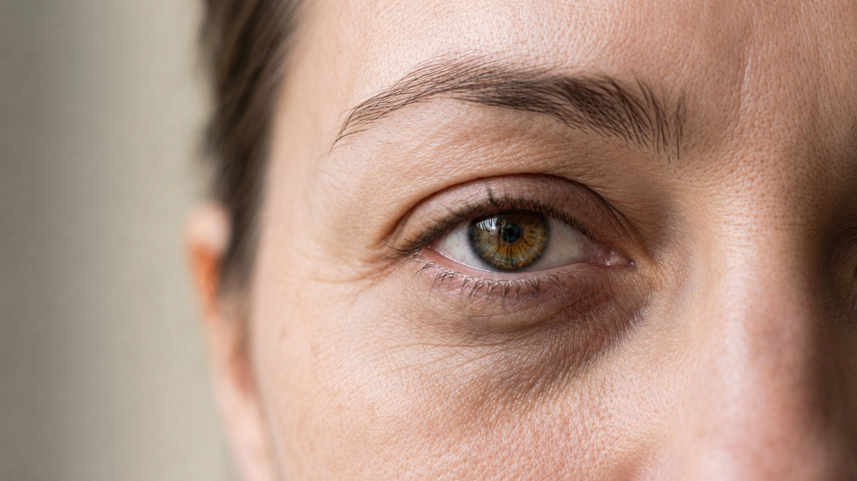 Close-up of an eye showing under-eye dark circles and fine lines