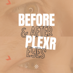 Vertical graphic of two stacked close-up photos of an eye area, tinted tan, with the text "Before & After Plexr Eyes" and giasena.ca over the top