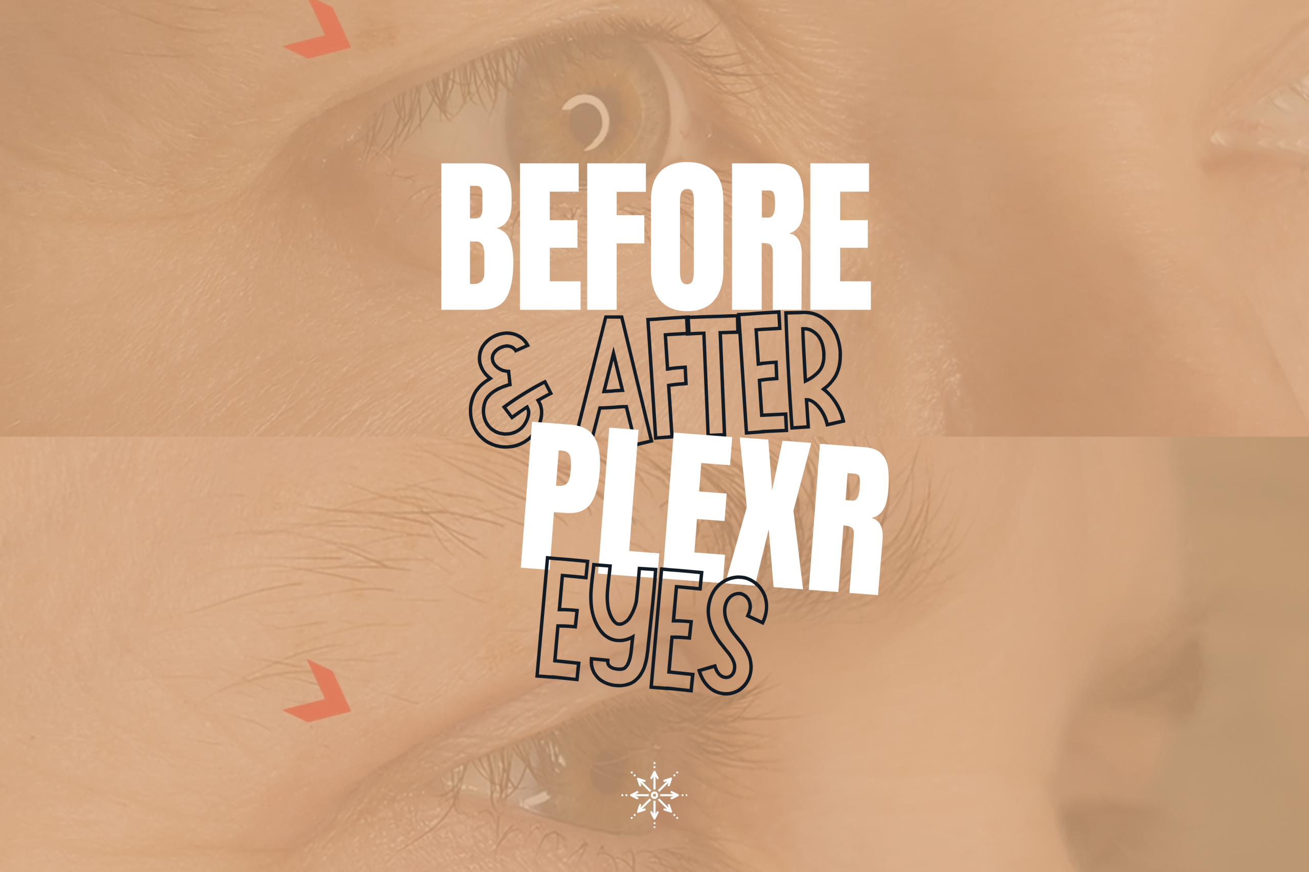 Vertical graphic of two stacked close-up photos of an eye area, tinted tan, with the text "Before & After Plexr Eyes" and giasena.ca over the top