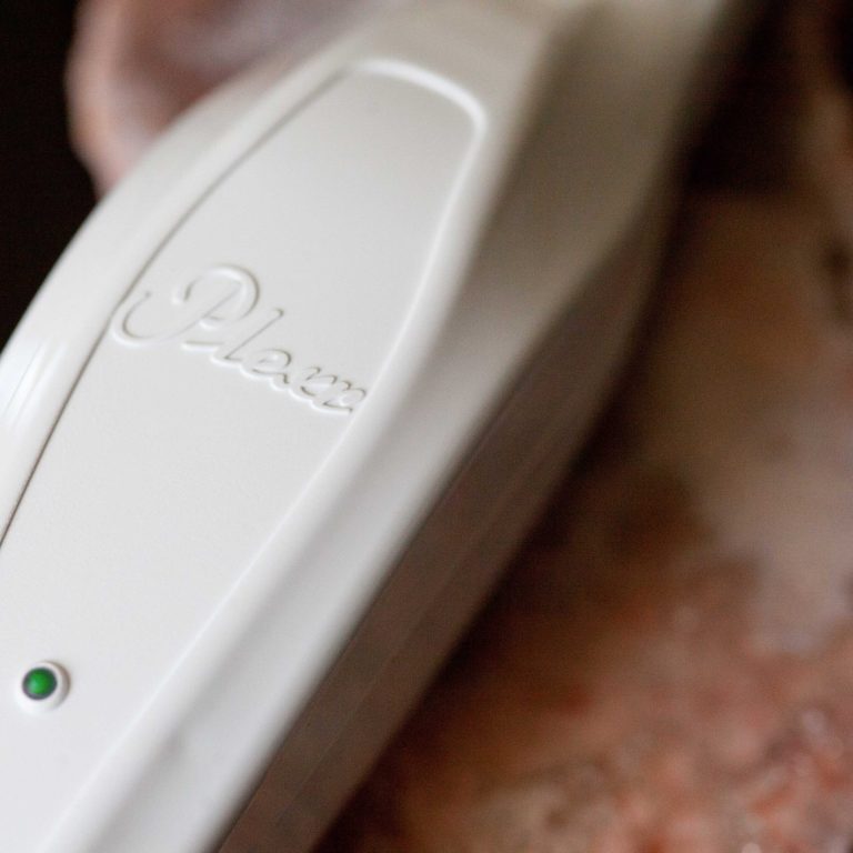 Close-up of the Plexr plasma medical aesthetics device used for non-surgical skin treatments